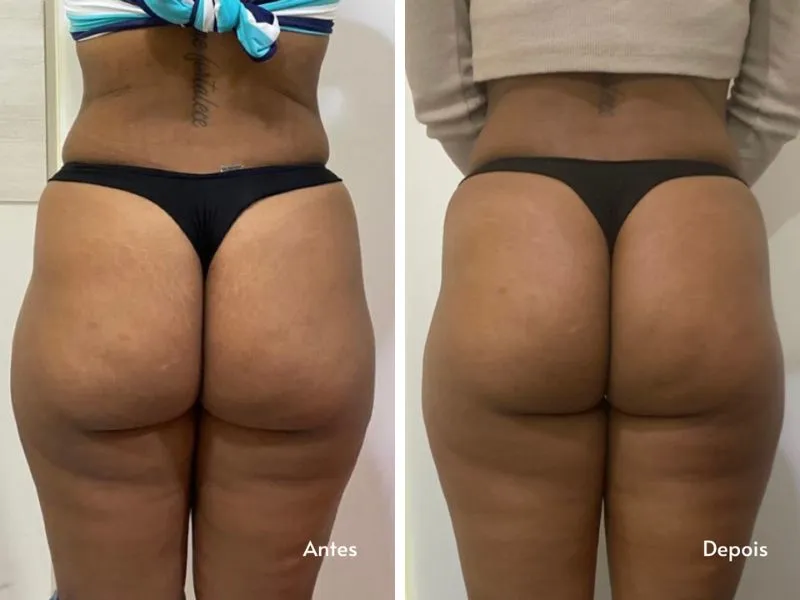 Heccus — Terapia Combinada — imagem 1