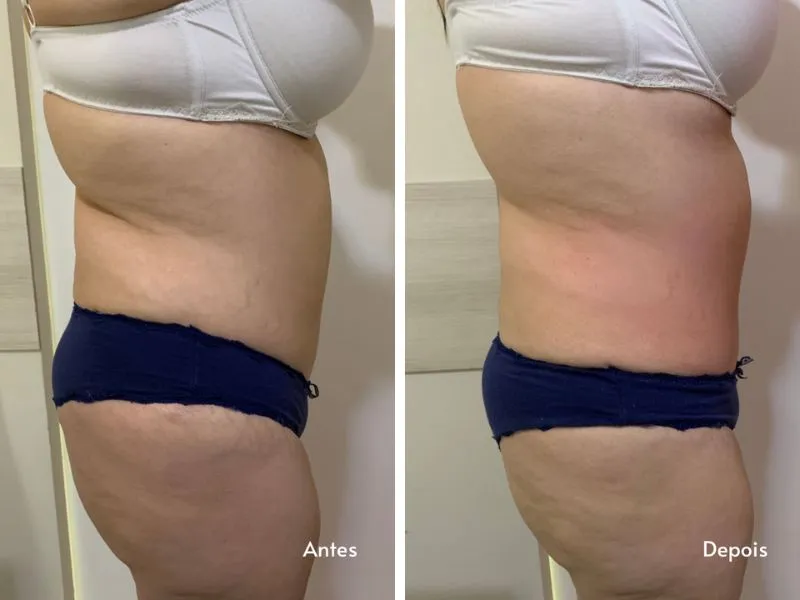Heccus — Terapia Combinada — imagem 2