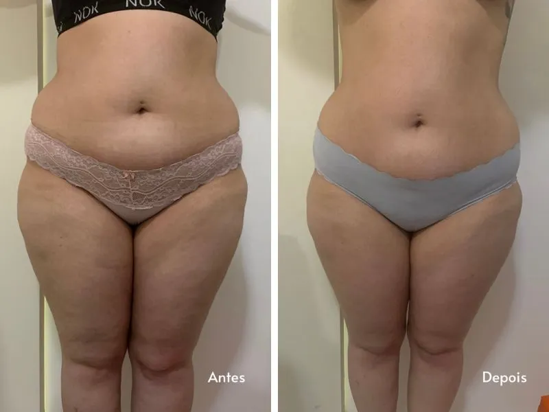 Uno ABS — imagem 3