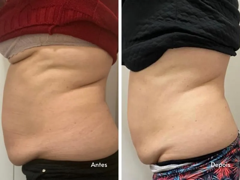 Uno ABS — imagem 2