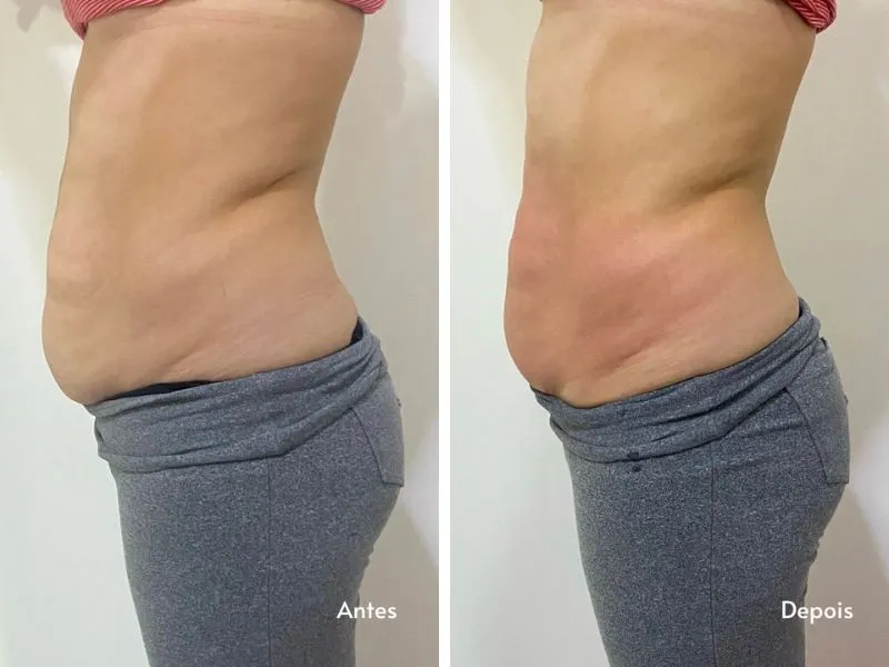 Uno ABS — imagem 1