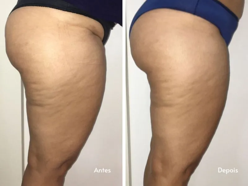 Uno Shape — Unolaser, Chácara Santo Antônio SP