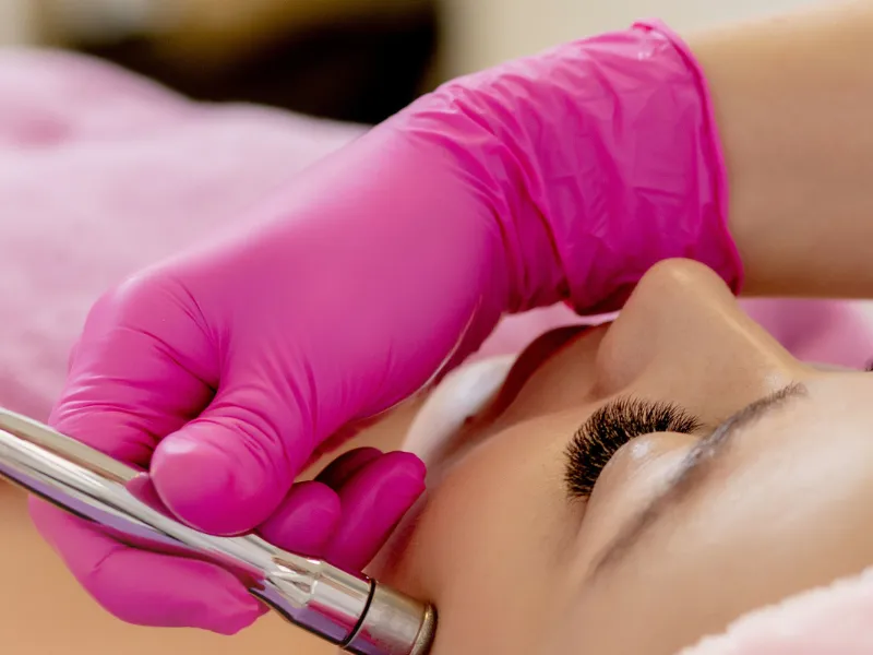 Microagulhamento facial — antes do tratamento na Unolaser
