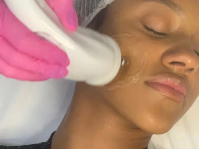 Flacidez Facial — imagem 4