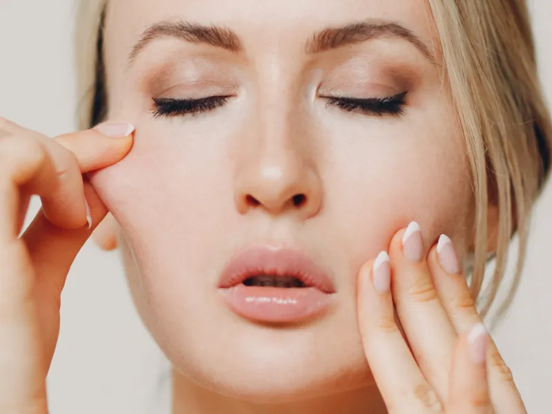 Flacidez Facial — imagem 3