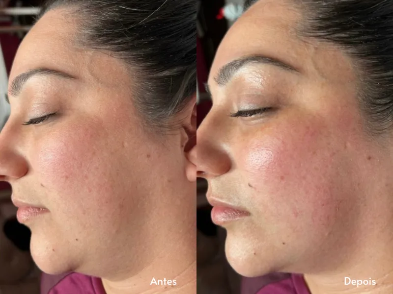 Miracle Face — imagem 2