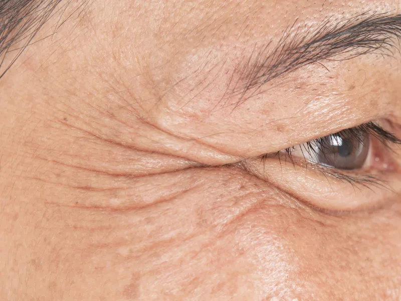 Rejuvenescimento Facial — imagem 3