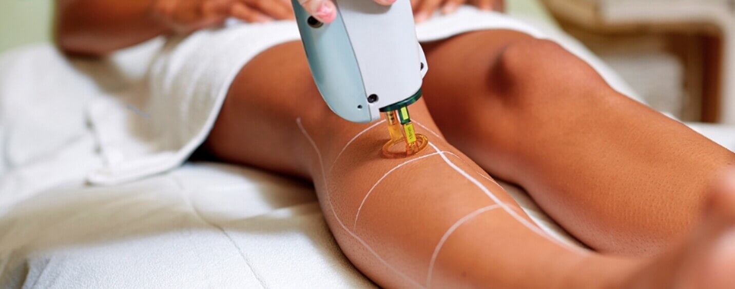 Equipamento Laser Alexandrite